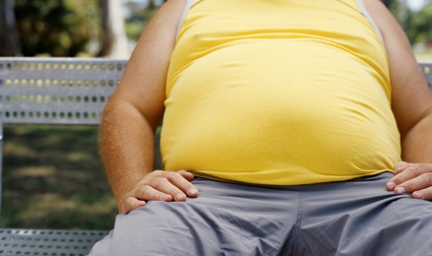 obesity