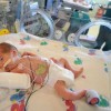 premature babies premature babies